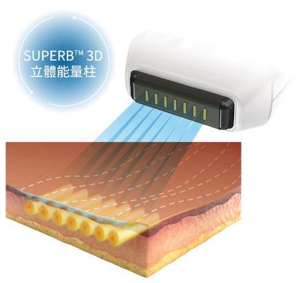 SUPERB™ 3D 立體能量柱