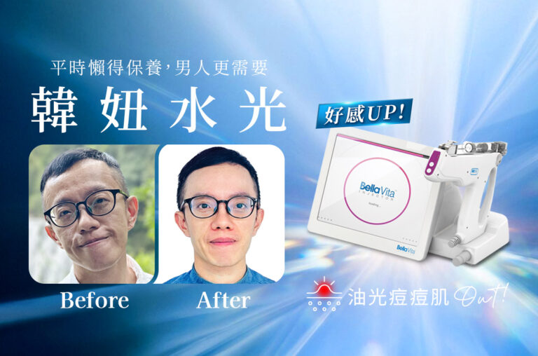 男生一定要試一次！水飛梭＋水光帶來的「精神感」差很大